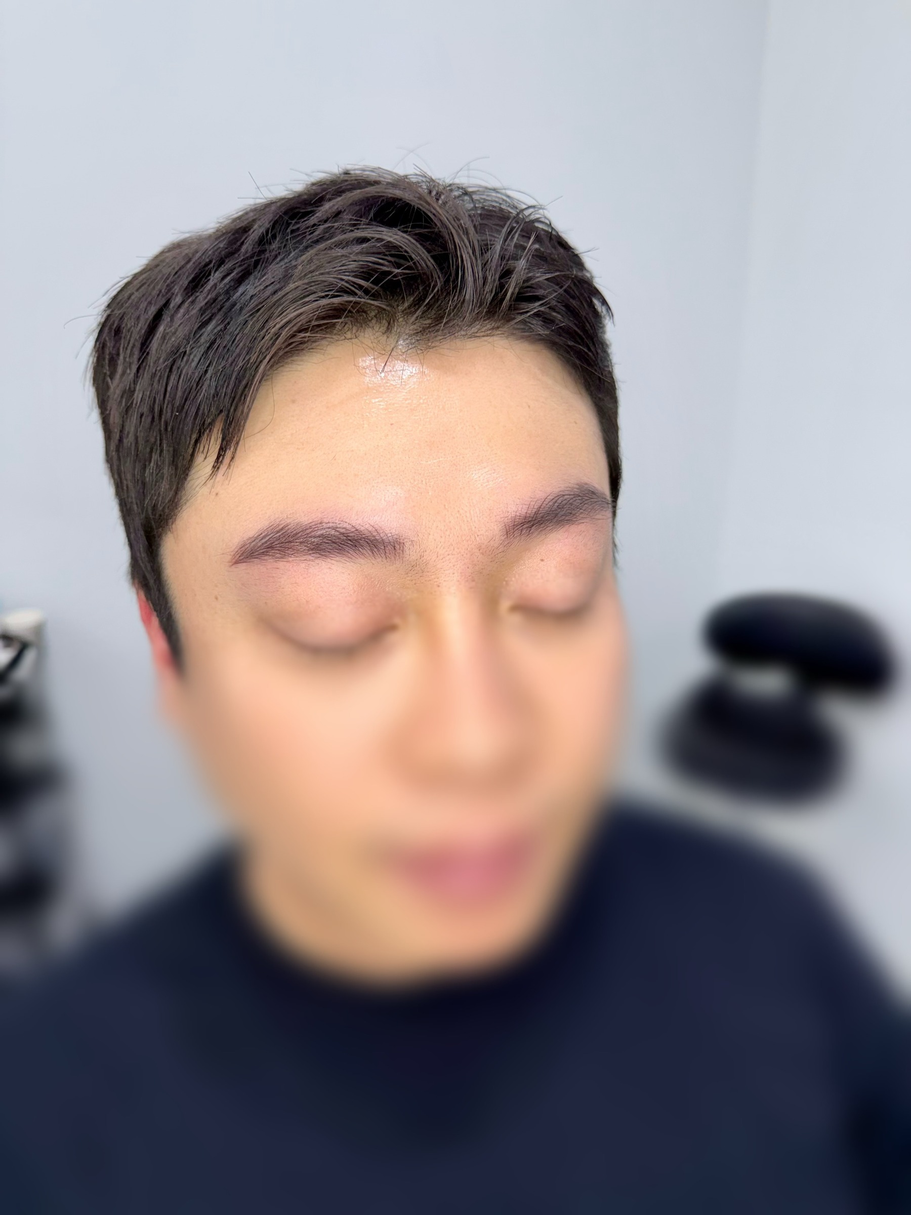 시술 후